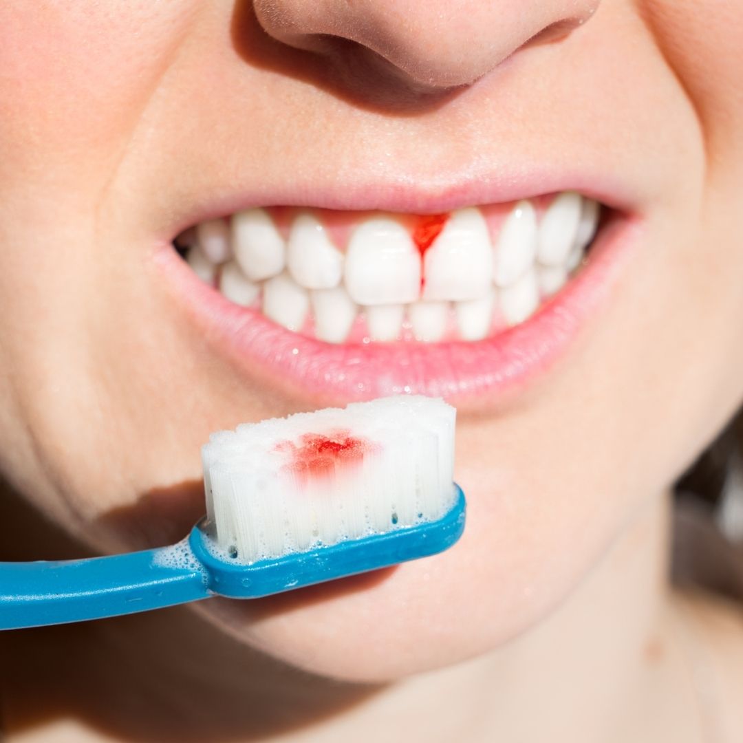 gum-disease-can-affect-overall-health